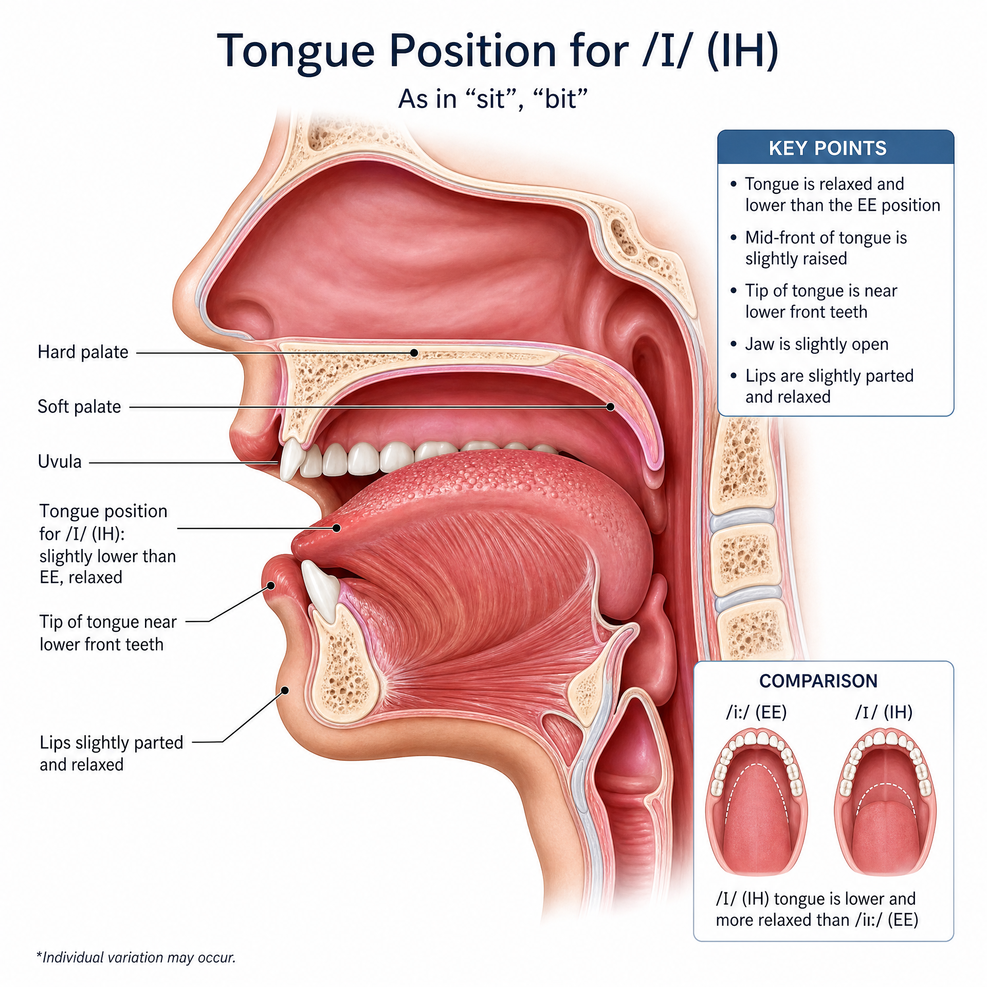 IH Tongue Position